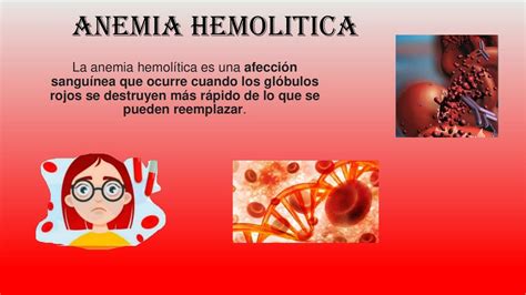 alemia|Anemia